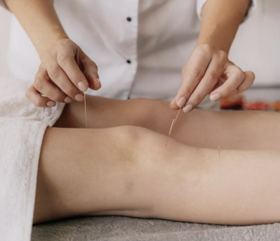 Acupuncture treatment for pain relief in Winnipeg