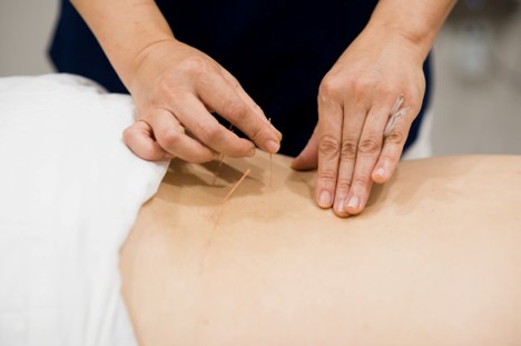 acupuncture at Jin Acupuncture & Massage